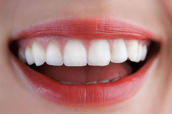 What to Expect from Teeth-In-A-Day Dental Implant Procedures