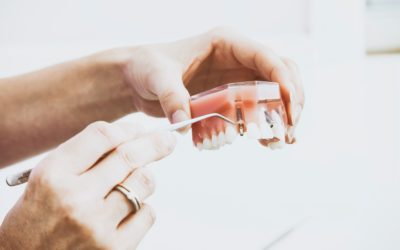 Is dental hygiene important