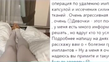 Image with missing alt attribute found on m24.ru