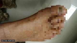Believers Brutally Tortured for Their Faith