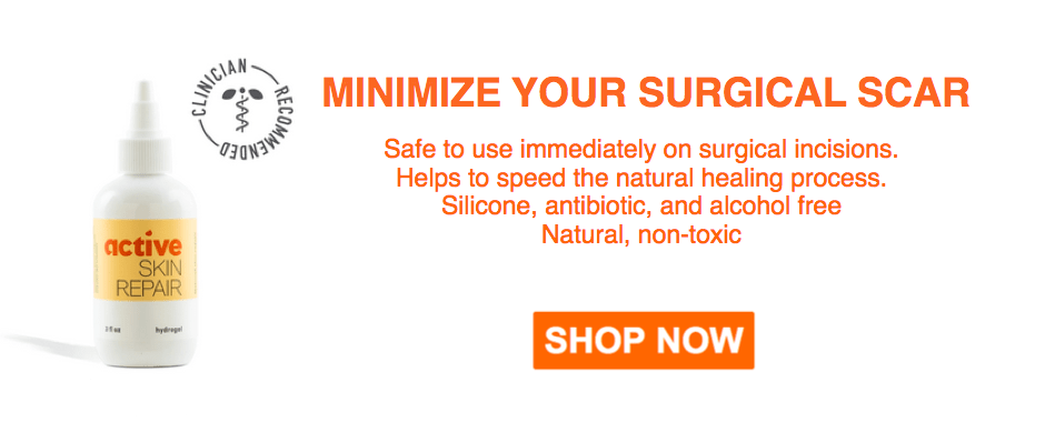 https://bonesmart.org/wp-content/uploads/2019/10/scar-shield-front-slider-940x389-v3.png