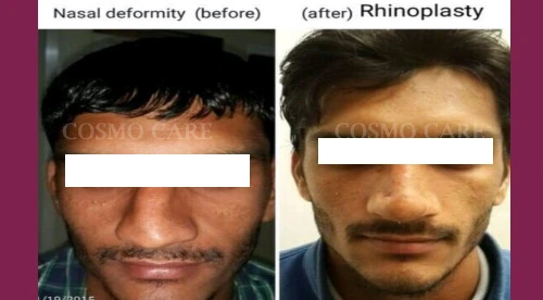 Image with missing alt attribute found on cosmocarejaipur.in