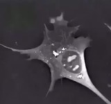 Umierający neuron