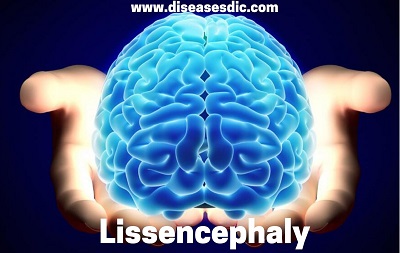 Image with missing alt attribute found on diseasesdic.com