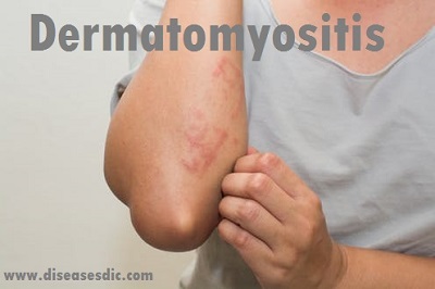 Image with missing alt attribute found on diseasesdic.com