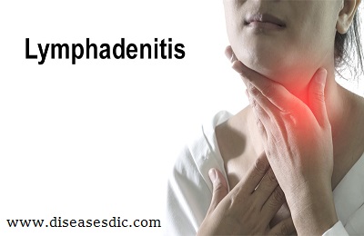Image with missing alt attribute found on diseasesdic.com