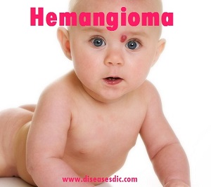 Image with missing alt attribute found on diseasesdic.com