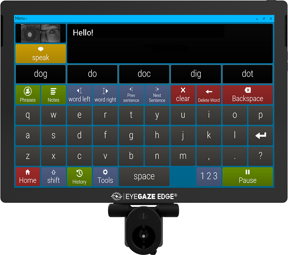 Image with missing alt attribute found on eyegaze.com
