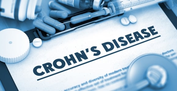 10 Symptoms of Crohn's Disease