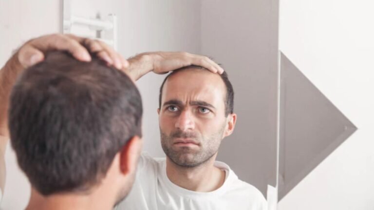 Minoxidil For Men
