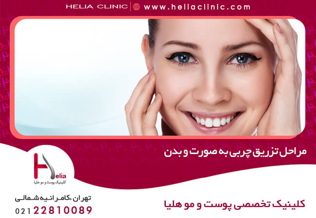 تزریق چربی به صورت