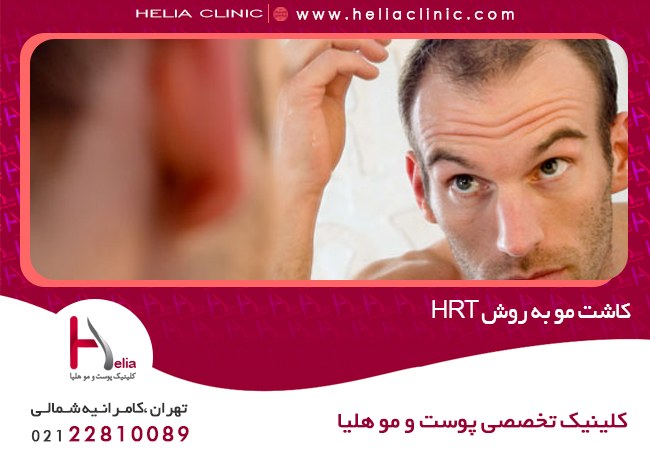 کاشت مو به روش hrt