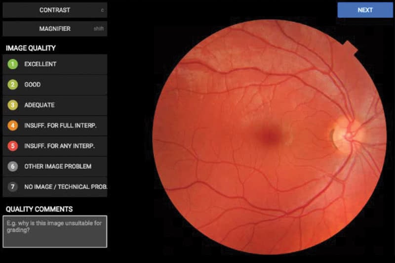 JAMA Art and Images in Psychiatry image