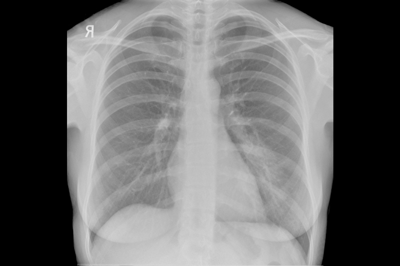 Image with missing alt attribute found on jamanetwork.com