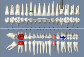 Image with missing alt attribute found on opendental.com