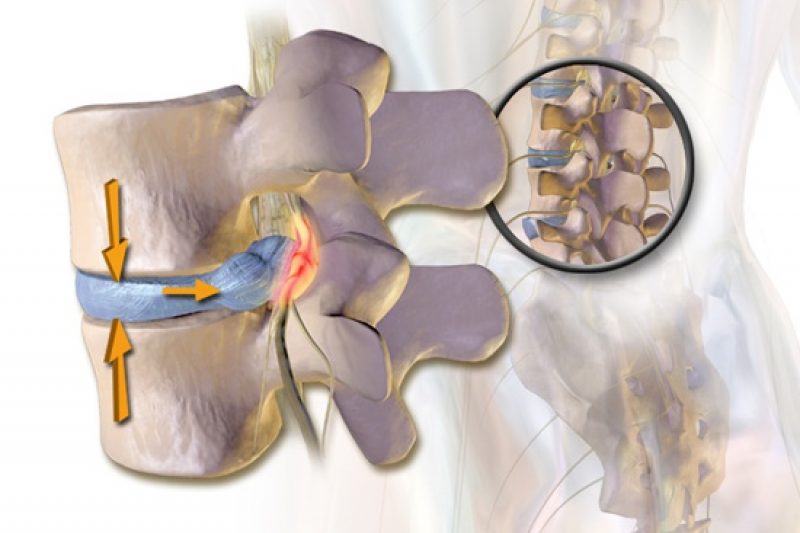 Image with missing alt attribute found on startingstrength.com