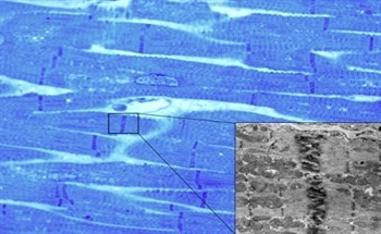 Why You Should (Re)Consider FTIR Imaging