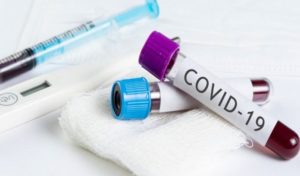 Coronavirus, Campania a 2.231 casi. Nel Paese 837 vittime oggi