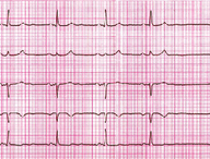 Image with missing alt attribute found on mp.pl