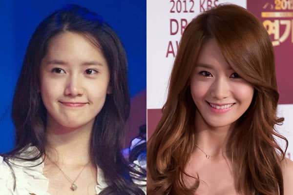 Yoona Cosmetic Surgery?