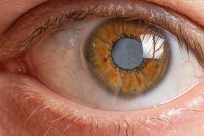 eye care