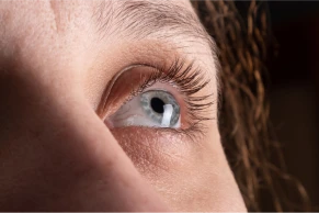 Lens keratoconus