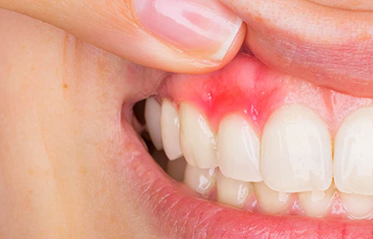 Image with missing alt attribute found on toothzone.com.au