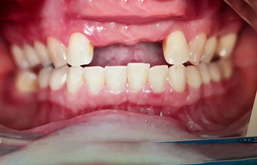 Image with missing alt attribute found on toothzone.com.au
