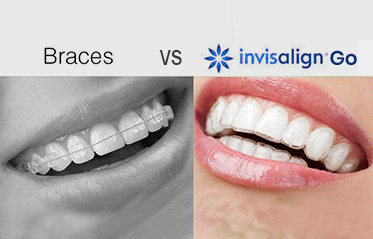 Image with missing alt attribute found on toothzone.com.au
