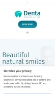 How allon4dentalimplantsoc.com looks like on a mobile device such as an iPhone.