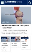 How arthritis-health.com looks like on a mobile device such as an iPhone.
