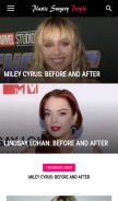 How plasticsurgerypeople.com looks like on a mobile device such as an iPhone.