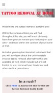 How tattoo-removal-at-home.weebly.com looks like on a mobile device such as an iPhone.